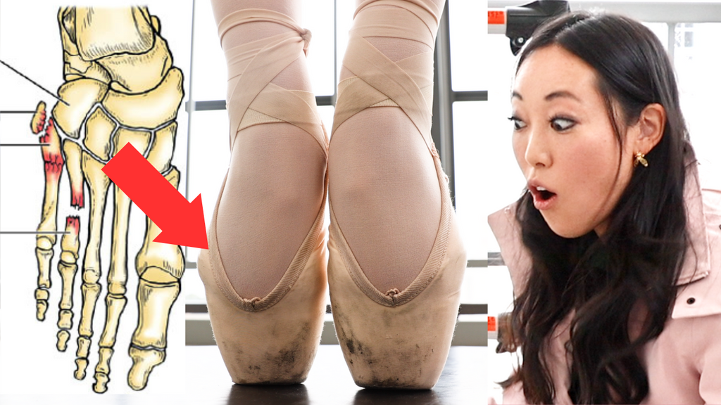 Dancer Breaks Foot En Pointe